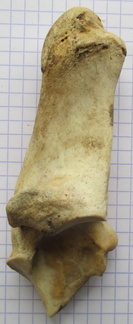 Calcaneum med1