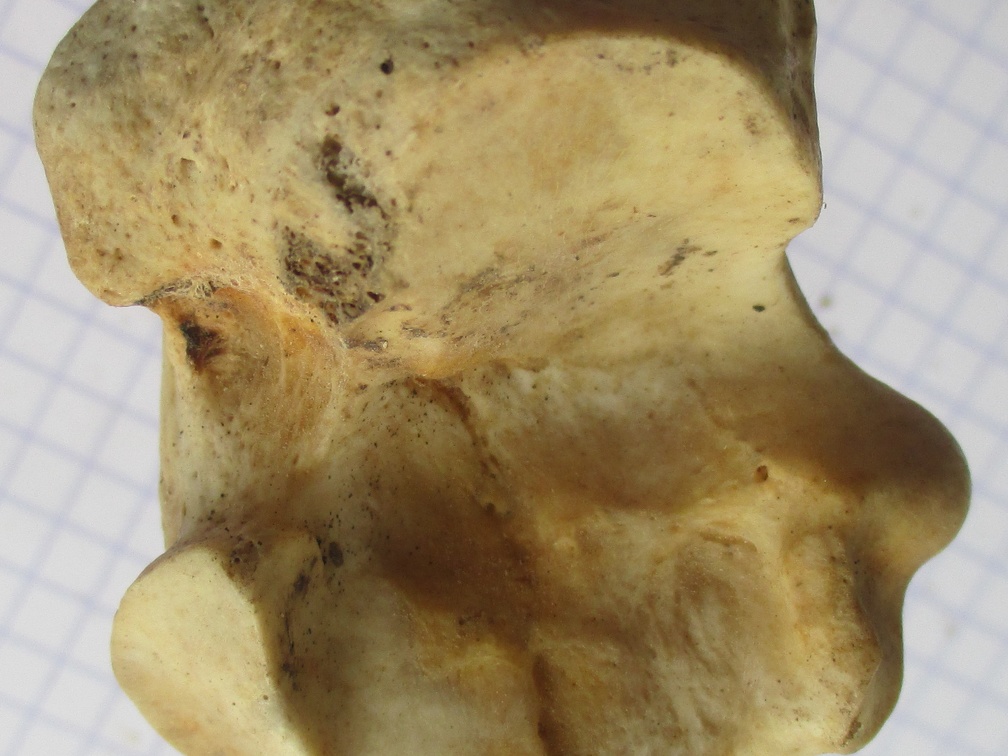 Calcaneum med2 (15137 visites) Calcaneum med2