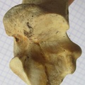 Calcaneum med2 (15164 visites) Calcaneum med2