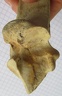 Calcaneum med2