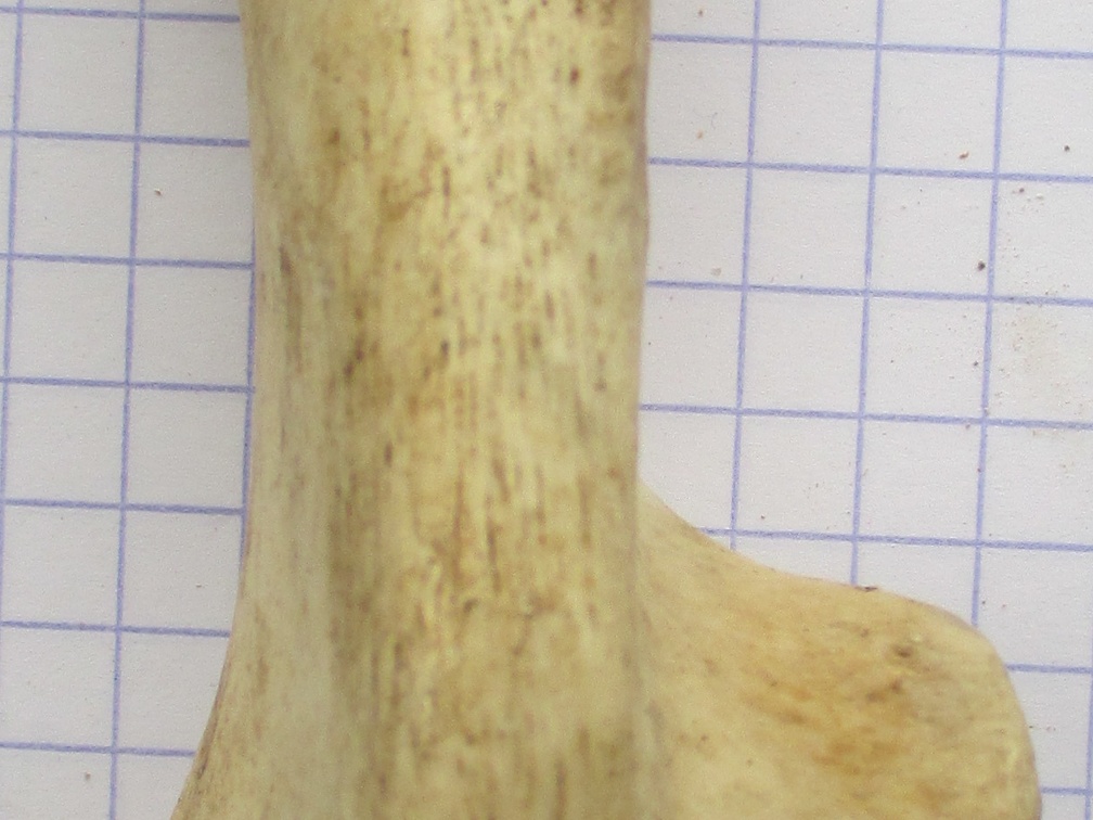Calcaneum plant (16624 visites) Calcaneum plant