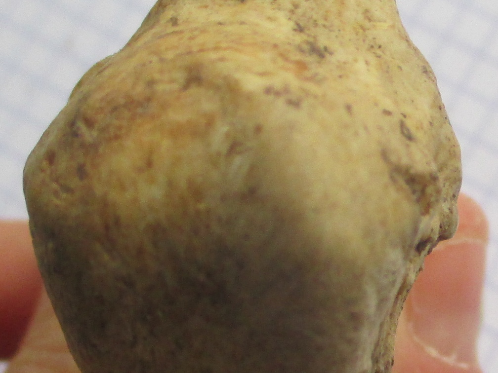 Calcaneum prox (15312 visites) Calcaneum prox