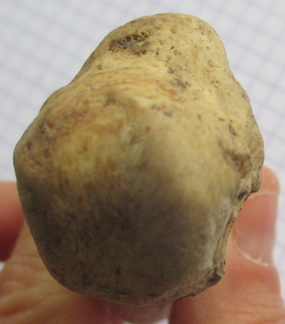 Calcaneum prox