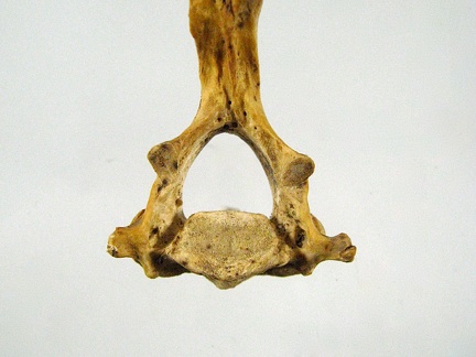 Vertebres cervicales Axis posterieur