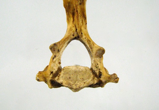 Vertebres cervicales Axis posterieur