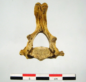 Vertebres cervicales Axis posterieur