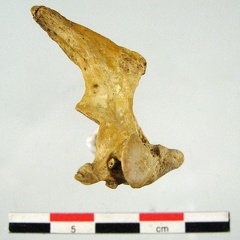 Vertebres cervicales Axis lateral D