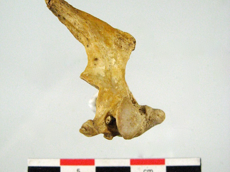 Vertebres cervicales Axis lateral D