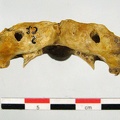Vertebres cervicales Atlas superieur (14397 visitas) Vertebres cervicales Atlas superieur