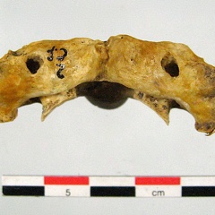 Vertebres cervicales Atlas superieur (14381 visites) Vertebres cervicales Atlas superieur