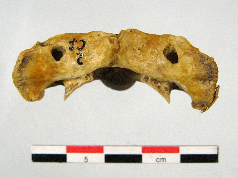 Vertebres_cervicales_Atlas_superieur.jpg