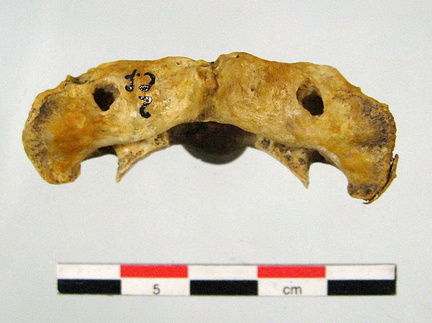 Vertebres cervicales Atlas superieur