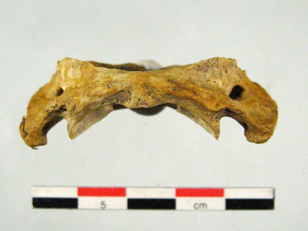 Vertebres cervicales Atlas inferieur (14579 visites) Vertebres cervicales Atlas inferieur