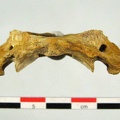 Vertebres cervicales Atlas inferieur (14626 visites) Vertebres cervicales Atlas inferieur