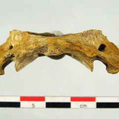 Vertebres cervicales Atlas inferieur (14584 visites) Vertebres cervicales Atlas inferieur