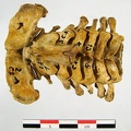 Vertebres cervicales superieur (16014 visitas) Vertebres cervicales superieur