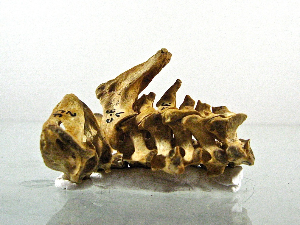 Vertebres cervicales lateral G (12894 visites) Vertebres cervicales lateral G