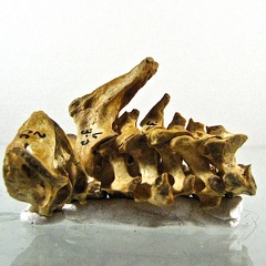 Vertebres cervicales lateral G (12894 visites) Vertebres cervicales lateral G