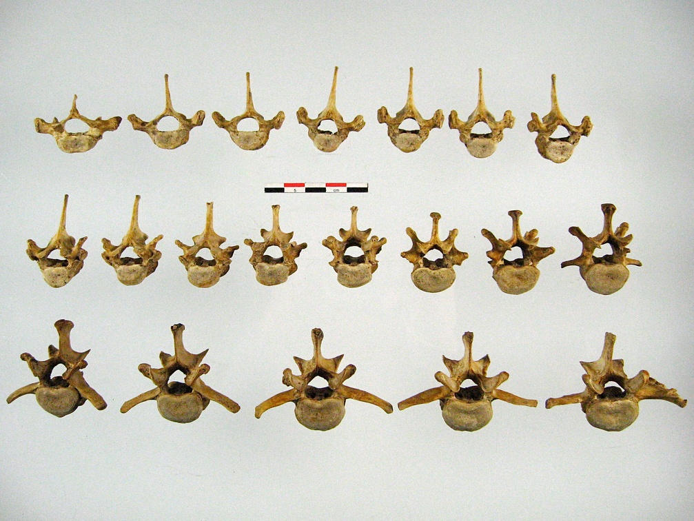 Vertebres thoraciques lombaires anterieur (12184 visites) Vertebres thoraciques lombaires anterieur