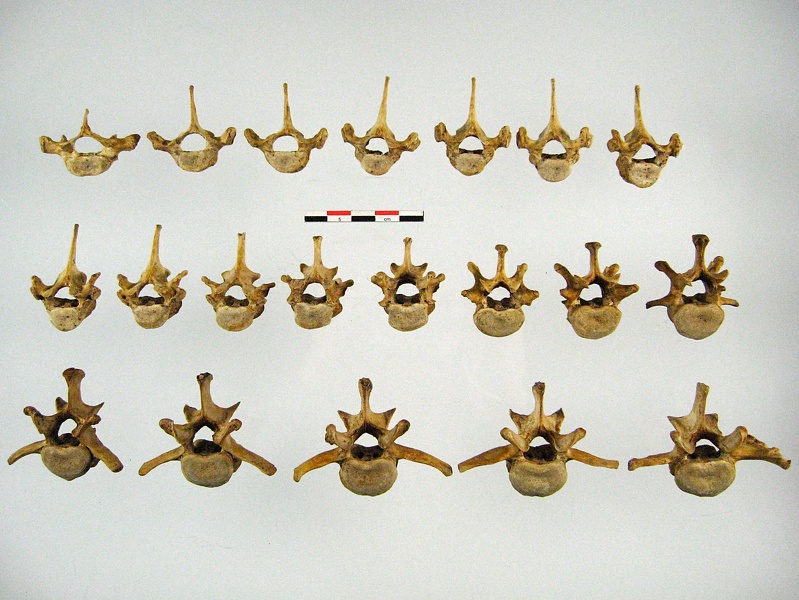 Vertebres thoraciques lombaires anterieur (12184 visites) Vertebres thoraciques lombaires anterieur