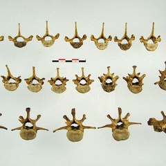 Vertebres thoraciques lombaires posterieur (11675 visites) Vertebres thoraciques lombaires posterieur