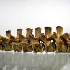 Vertebres thoraciques lombaires lateral G 01 (13169 visites) Vertebres thoraciques lombaires lateral G 01