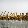 Vertebres thoraciques lombaires lateral G 02 (13256 visitas) Vertebres thoraciques lombaires lateral G 02