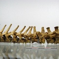 Vertebres_thoraciques_lombaires_lateral_G_02.jpg