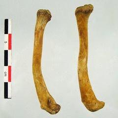 Clavicules 01