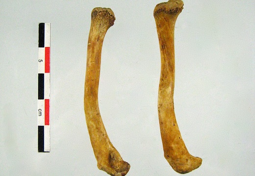 Clavicules 01 (11122 visites) Clavicules 01