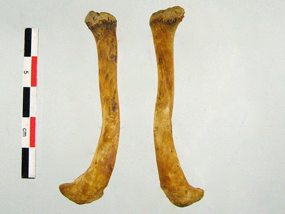 Clavicules 02 (11334 visites) Clavicules 02