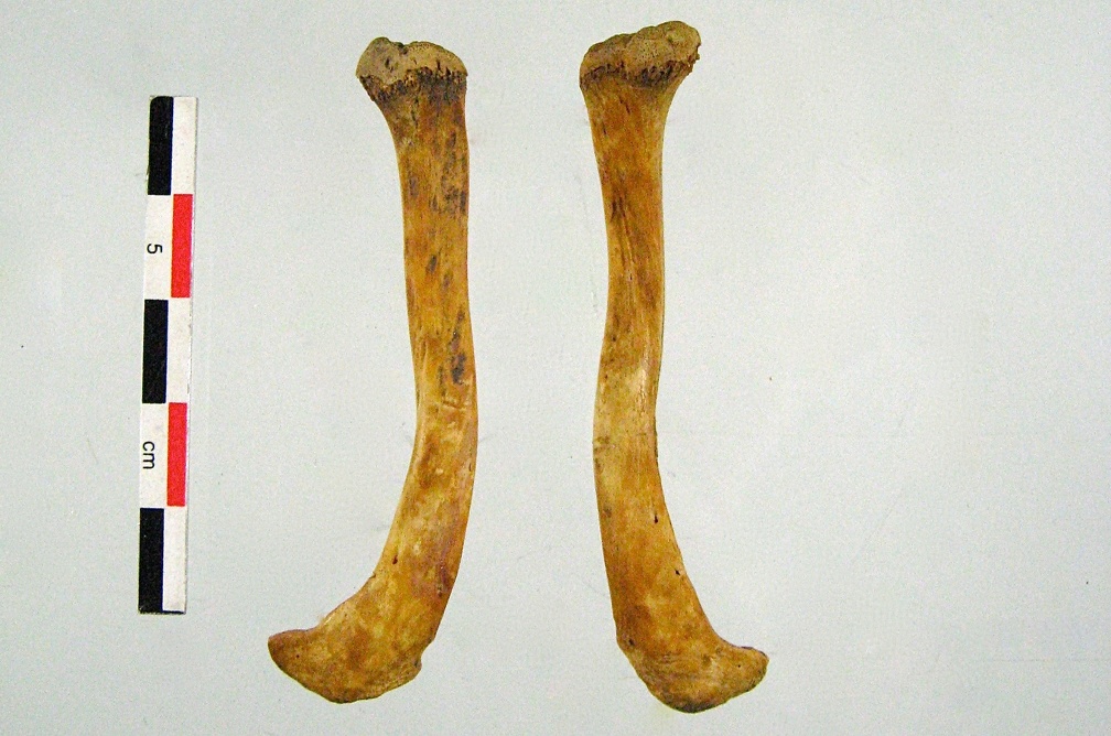 Clavicules 02