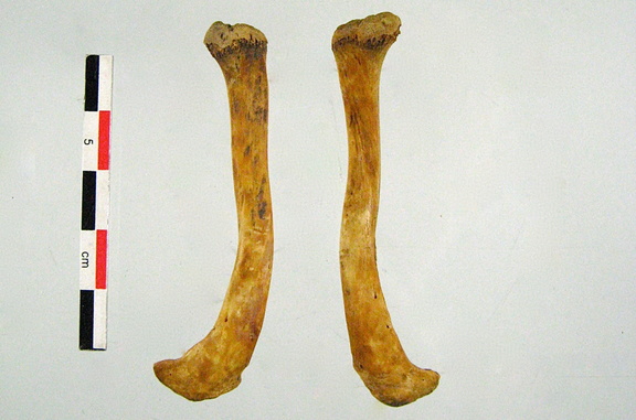 Clavicules 02