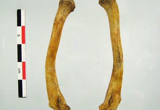 Clavicules 03 (10773 visites) Clavicules 03