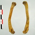 Clavicules_03.jpg