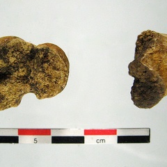 Humerus prox distal (17649 visitas) Humerus prox distal