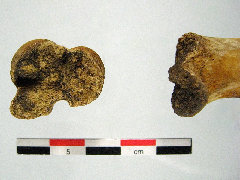 Humerus prox distal (17621 visites) Humerus prox distal