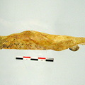 Mandibule inferieur