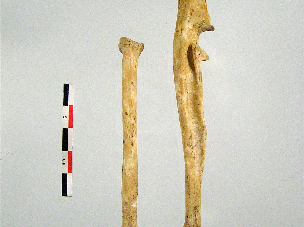 Radius Ulna posterieur