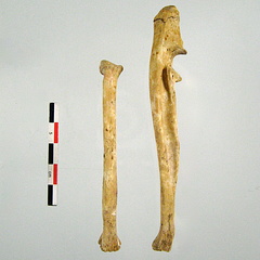 Radius Ulna posterieur (17138 visites) Radius Ulna posterieur