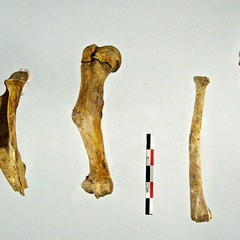 Scapula Humerus Radius Ulna 02