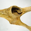 Os coxal acetabulum lateral