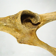 Os coxal acetabulum lateral (16638 visites) Os coxal acetabulum lateral
