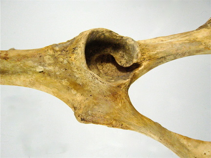 Os coxal acetabulum lateral