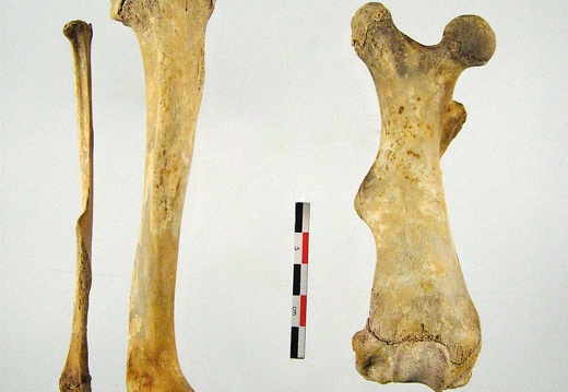 Femur Tibia Fibula