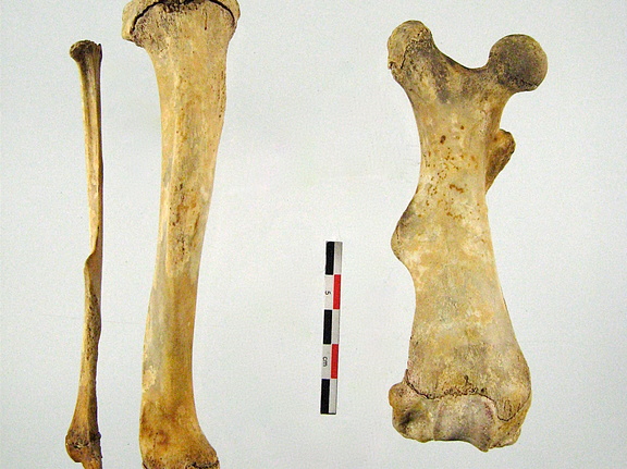 Femur Tibia Fibula