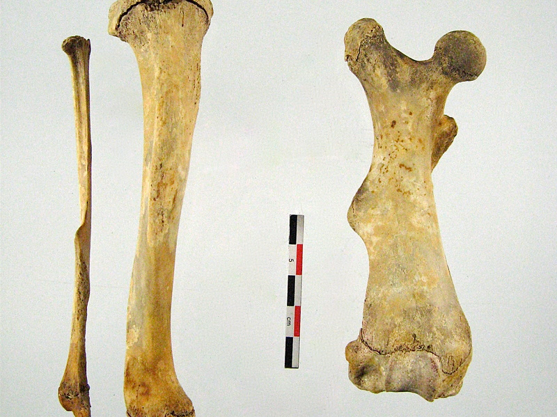 Femur Tibia Fibula (19703 visites) Femur Tibia Fibula