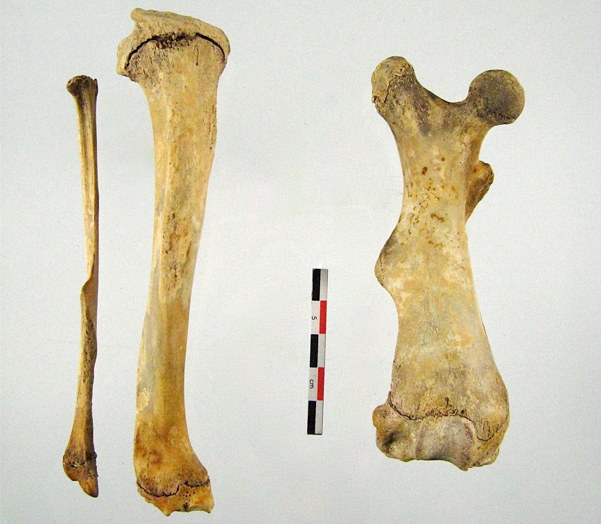 Femur Tibia Fibula