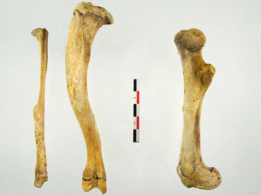 Tibia Fibula (18563 visites) Tibia Fibula