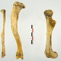 Tibia Fibula